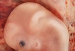 Cabeza de embrión de 9 semanas de embarazo