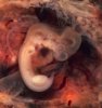 Embrión de 7 semanas