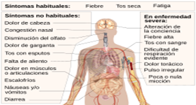 https://upload.wikimedia.org/wikipedia/commons/thumb/8/8c/Symptoms_of_coronavirus_disease_2019_2.0-es.svg/220px-Symptoms_of_coronavirus_disease_2019_2.0-es.svg.png